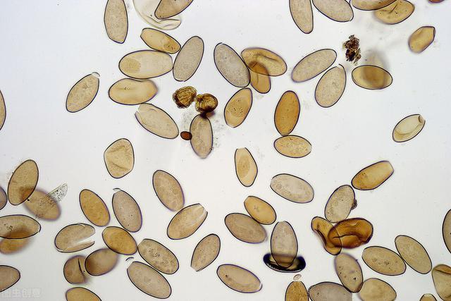 一口1000个肝脏寄生虫,多条美食街中招,别再让孩子吃了!