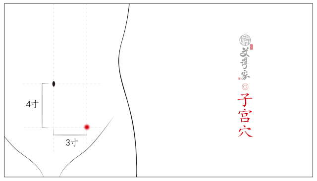 調整消化系統; 神闕,關元:用以匡扶正氣,固本培元; 子宮,歸來,八髎:用