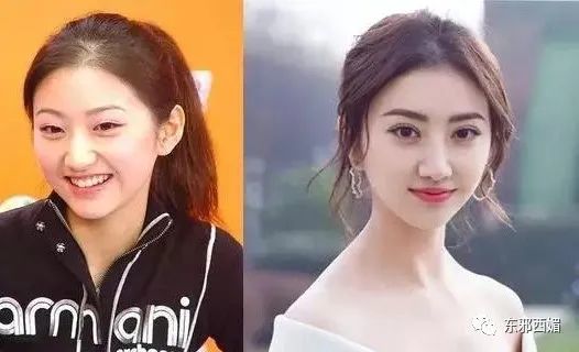 大甜甜|双眼皮修复太成功了吧！大甜甜的变美改造工程，有点东西