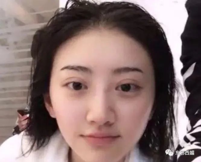 大甜甜|双眼皮修复太成功了吧！大甜甜的变美改造工程，有点东西