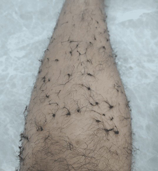 "腿毛太浓密不如打个结,看起来洋气不少!"哈哈哈天生自带毛裤!