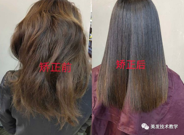 缩毛矫正,毛发微整