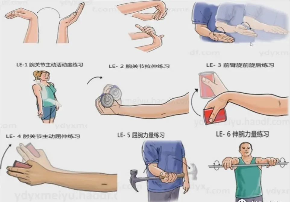 网球肘的来龙去脉
