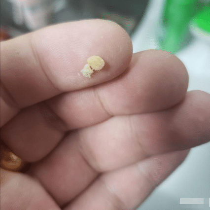 不知道大家有没有在某时间段打喷嚏的时候咳出来这玩意.