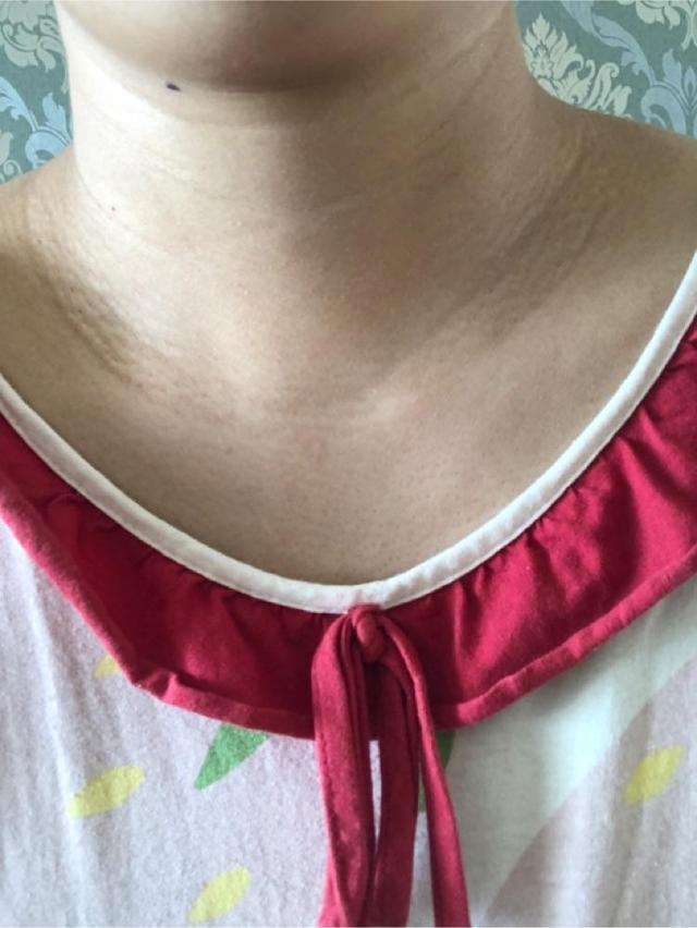 怀孕后为什么很多地方都变黑这代表宝宝发育的好不用过分担心