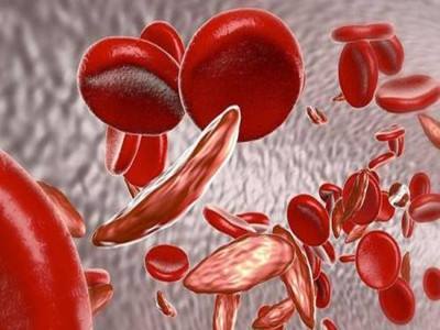 贫血|什么是溶血性贫血？溶血性贫血的症状-血液病专家史淑荣