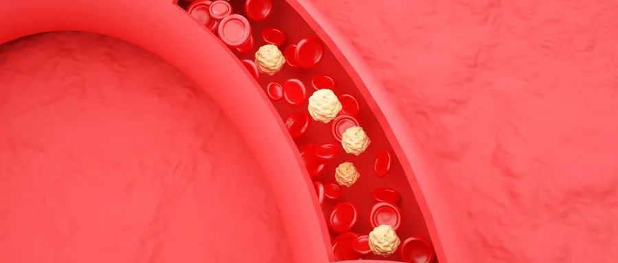 甲状腺功能减退|血脂总降不下？中老年人，快查查你的甲状腺