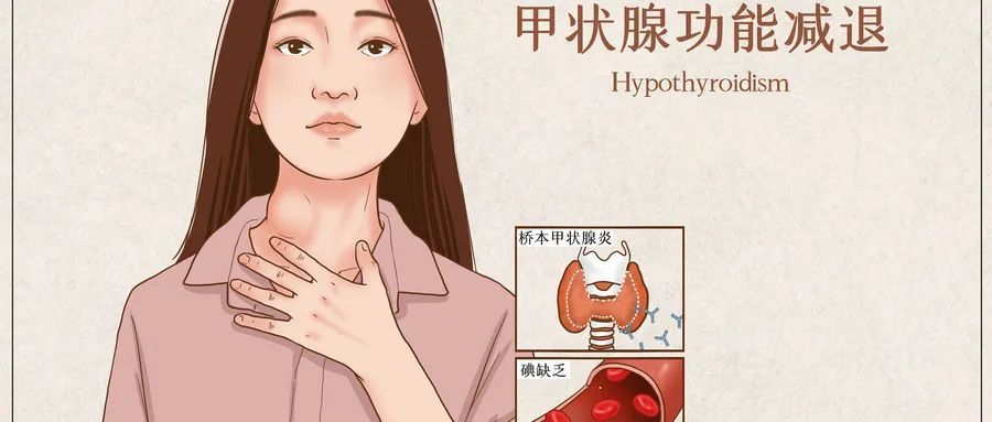 甲状腺功能减退|血脂总降不下？中老年人，快查查你的甲状腺