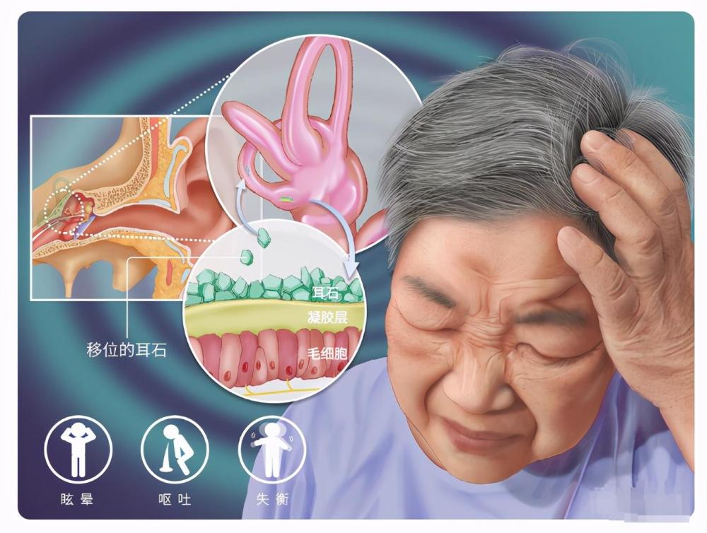 老人头晕 老人头晕是什么原因引起的