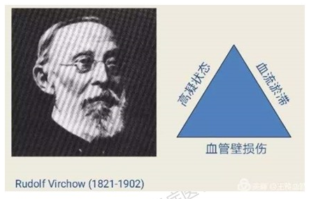 住院患者的潜在杀手肺栓塞