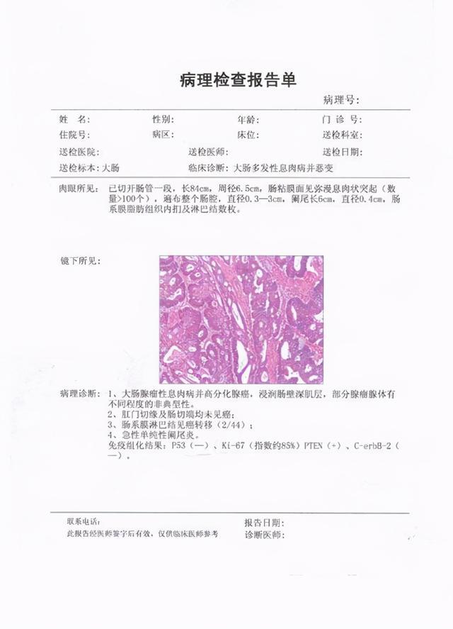 3,只有病理活檢確診為癌症,才能開展放化療,免疫治療,靶向治療.