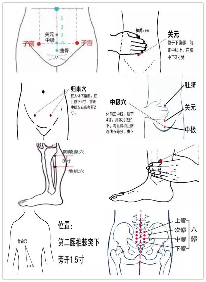 痛經只知道吃止疼藥針灸這麼好的方法竟然不知道