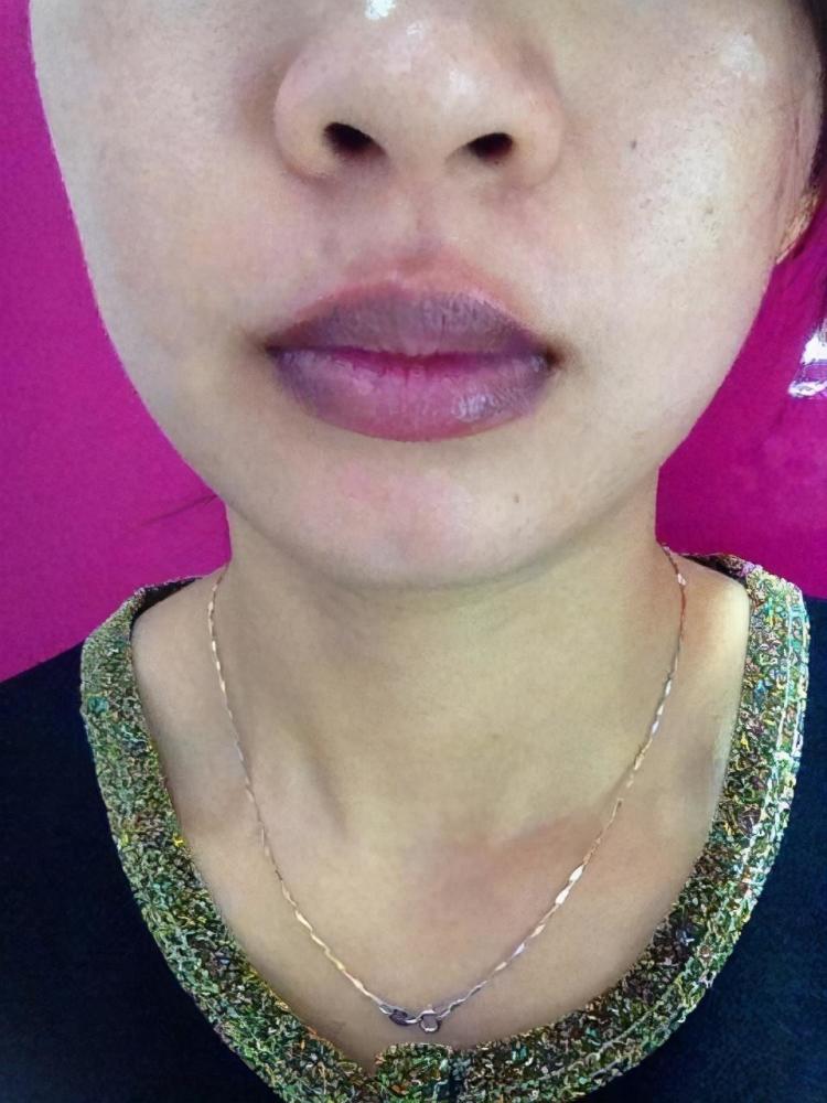 嘴唇发紫是什么原因「人的嘴唇发紫是什么原因」