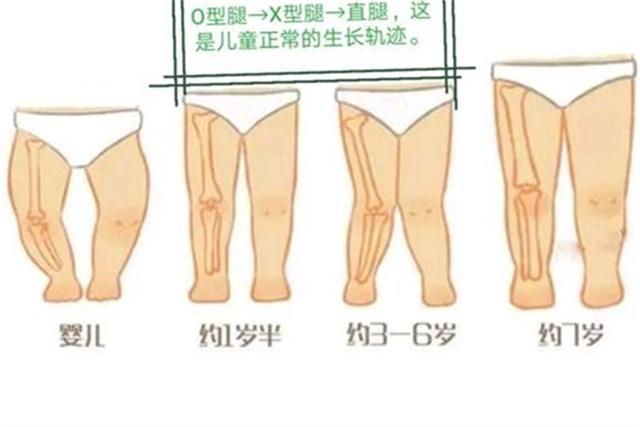 父母的4种做法,可能导致宝宝骨骼畸形,别大意,不少人犯