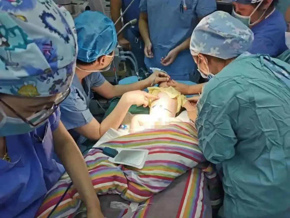 罕见江西一男婴刚满月又生了一个宝宝