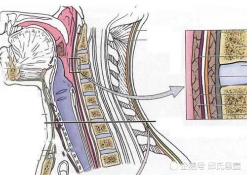 如何确定自己得了颈椎病 邱颈椎 腾讯新闻