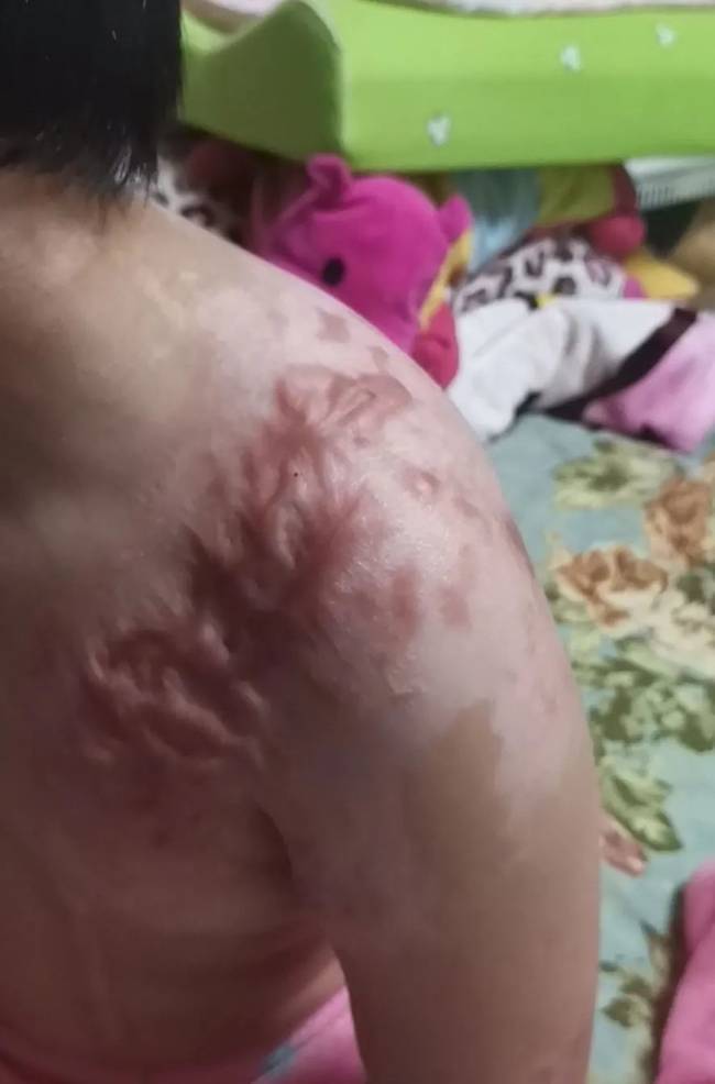 抚顺6岁被虐女童父亲望严惩前妻和她男友,给孩子一个交代