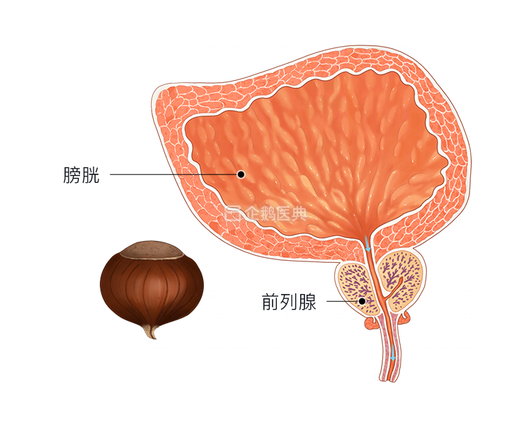 前列腺癌是打飞机太多引起的 答案你绝对想不到 全网搜