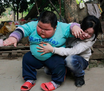 小孩太胖怎么?肥胖也是一种病得治