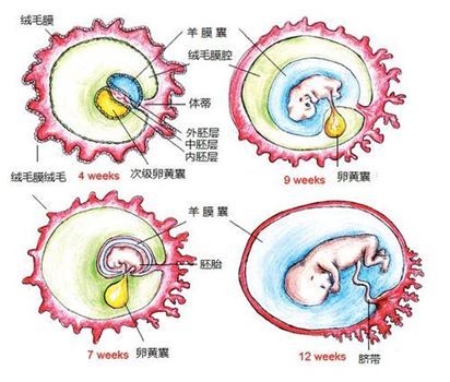 中发生障碍,就会产生各种类型的卵黄管残留异常,如脐肠瘘,脐窦和脐茸