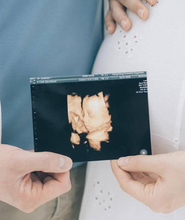 叶晴晴|恭喜！香港著名女歌手宣布顺利产女，宝宝因体重偏重提前出生