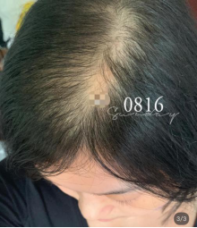 蓖麻油|涂抹蓖麻油＋薄荷油来生发？别被坑了！