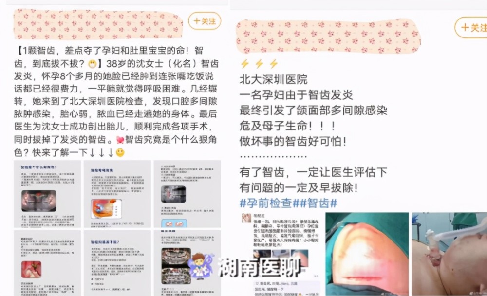 牙痛|孕期牙痛难忍，准妈咪只能硬扛吗？这篇文章告诉你该如何解决