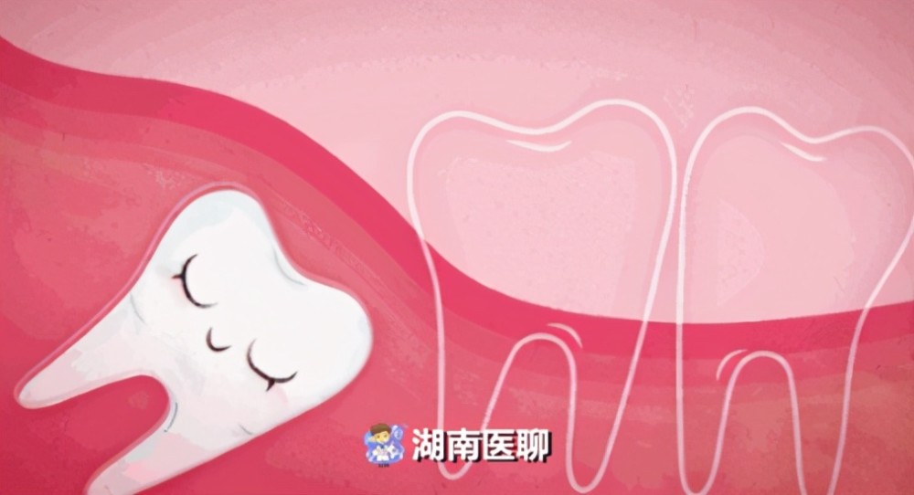 牙痛|孕期牙痛难忍，准妈咪只能硬扛吗？这篇文章告诉你该如何解决