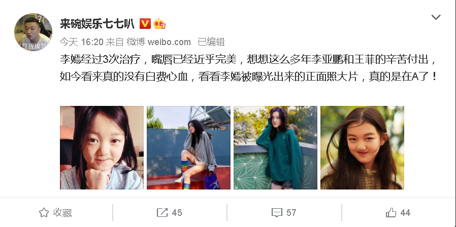 李嫣|李嫣嘴唇完美恢复？正面曝光后才知道，李亚鹏王菲多年努力没白费