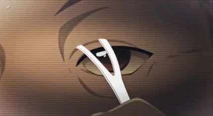 整容|剥皮、拆骨、家破人亡……整容女孩到底多没下限？