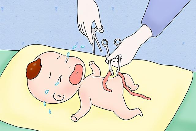 剪短脐带后,护士姐姐会在48小时后拿掉夹子,留下2~3cm的一段小伤口,让