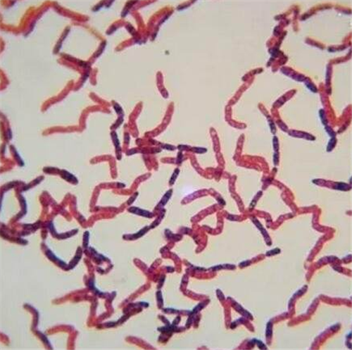 细菌|俄国男子发现350万年前细菌，为获永生冒险注射，如今已失去笑容