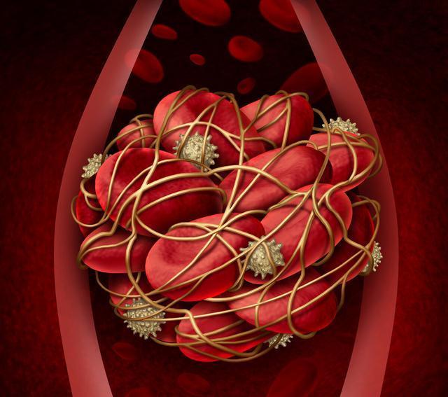 症状|血液黏稠会有哪些症状？如何判断调理？本文讲出实情