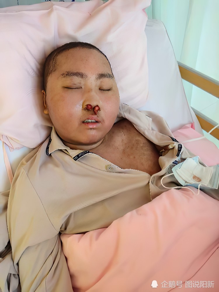 昔日富商一夜白头负债累累学霸儿子被切掉鼻子仍自信满满读书又不靠脸