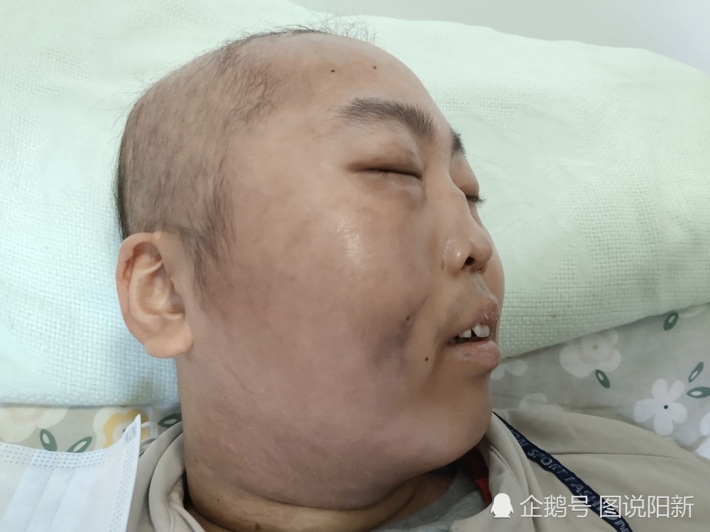 昔日富商一夜白头负债累累学霸儿子被切掉鼻子仍自信满满读书又不靠脸