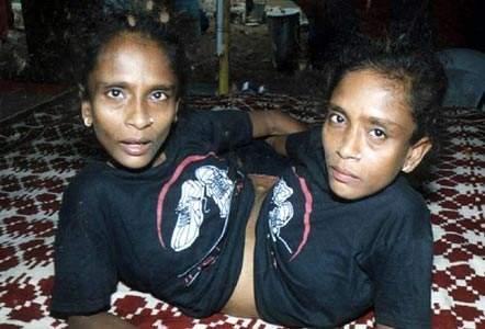 印度"连体姐妹"竟嫁同一老公,婚后三人怎么生活的?丈夫扬言:有点难