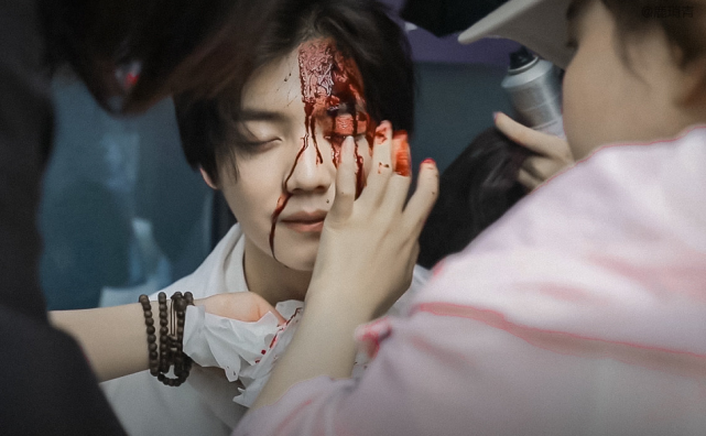 明星受伤妆:王源冷酷,范丞丞可怜,看到鹿晗:不能晚上看