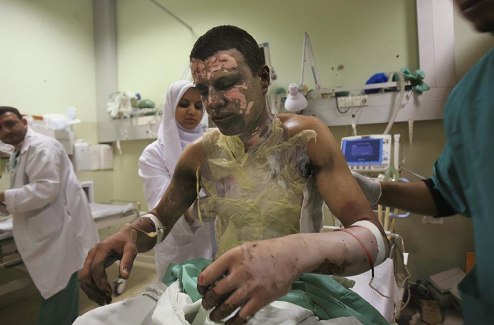 反人类武器阿塞拜疆被指使用恐怖白磷弹人被烧到后就剩骨头