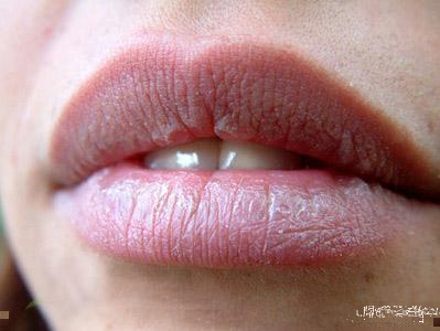 秋季嘴唇干裂脱皮怎么办 搞定唇炎可别错过它 必看 腾讯新闻