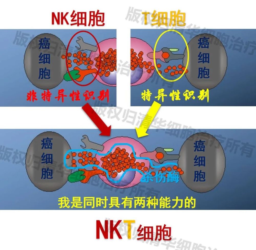 临床10年研究为什么nkt细胞的抗癌能力是nk细胞的上万倍