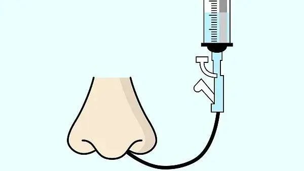 留置胃管并没有想象中那么可怕