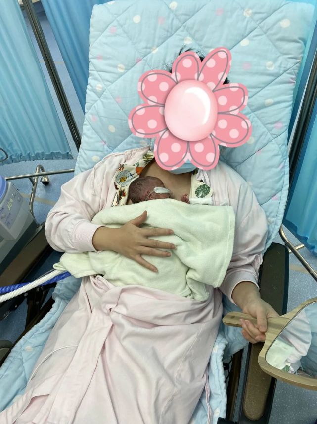 不足2斤宝宝生出来仅巴掌大出生就病危后来