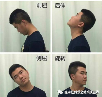 中医治疗痉挛性斜颈怎么样?这篇文章告诉你哦!