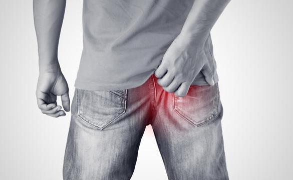 痔疮|痔疮很常见，你了解多少呢？