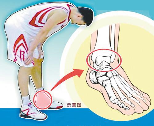 生涯第二年就骨折 为巅峰退役埋伏笔