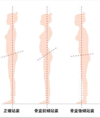 那樣也很醜,而且也會造成骨盆前傾;也不要歪著頭站,正確的站姿,應該是