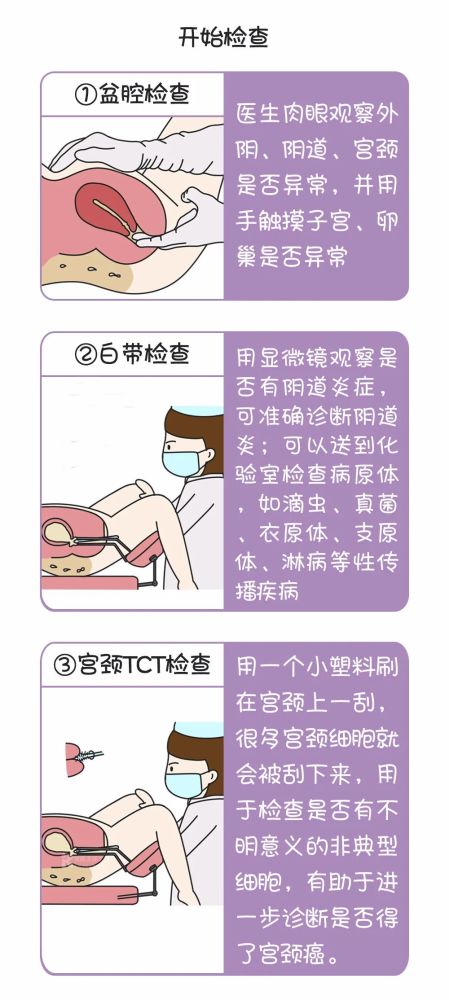 一,盆腔检查医生肉眼观察外阴,阴道,宫颈是否异常,并用手触摸子宫