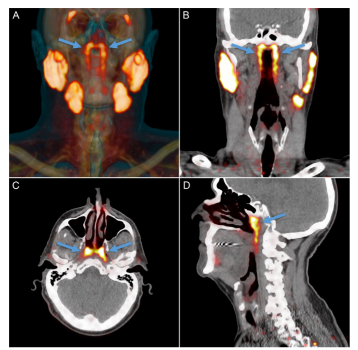 癌症|我们还在进化？科学家意外发现人体新器官