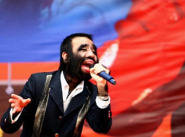 毛孩于震寰因返祖现象备受歧视如今开公司牵手90后美女