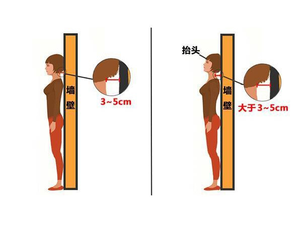 用一個動作判斷含胸駝背的程度